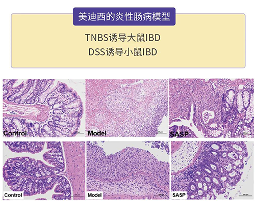 贝斯特全球最奢华的游戏平台的炎症性肠病模型