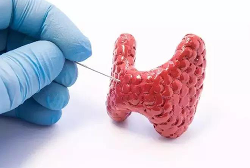 甲状腺疾病，包括甲状腺功能减退和甲状腺功能亢进，自古以来就是反复被医学研究人员研究的疾病