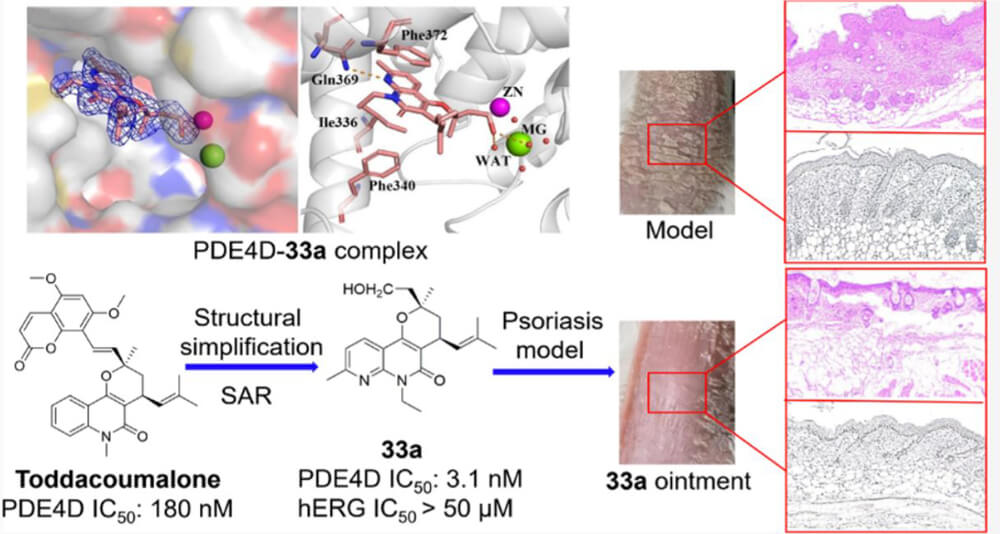 2-PDE4-is-an-effective-target-for-the-treatment-of-inflammatory-diseases-such-as-psoriasis--1.jpg 2-PDE4-is-an-effective-target-for-the-treatment-of-inflammatory-diseases-such-as-psoriasis--1.jpg